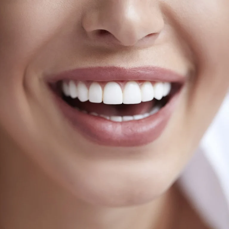 Dental crown placement in dubai for restored teeth