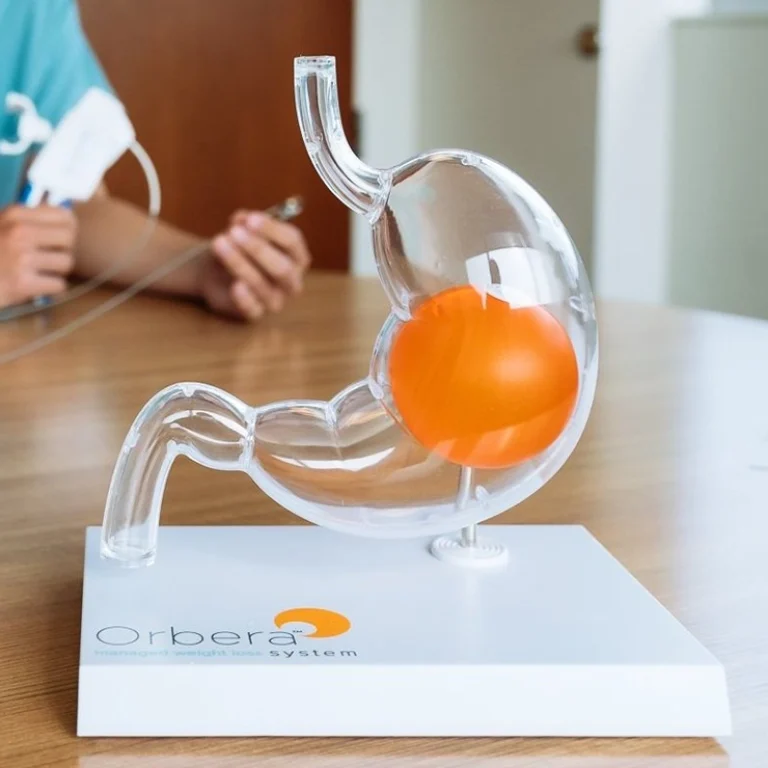 Gastric balloon insertion in dubai for safe weight loss by expert surgeons